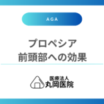 前頭部AGAにプロペシアを使う際の正しい知識 – 薄毛改善への道のりと目標設定