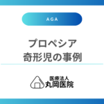 プロペシアの服用で奇形児が生まれる可能性はあるのか？胎児への影響事例と安全性