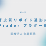 副腎皮質リポイド過形成症（Prader病） – 婦人科