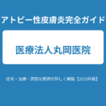 アトピー性皮膚炎完全ガイド｜症状・治療・原因を医師が詳しく解説【2025年版】